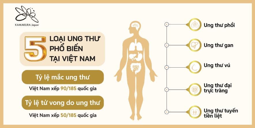 5 Bệnh Ung Thư Thường Gặp Ở Việt Nam Và Giải Pháp Điều Trị Hiệu Quả