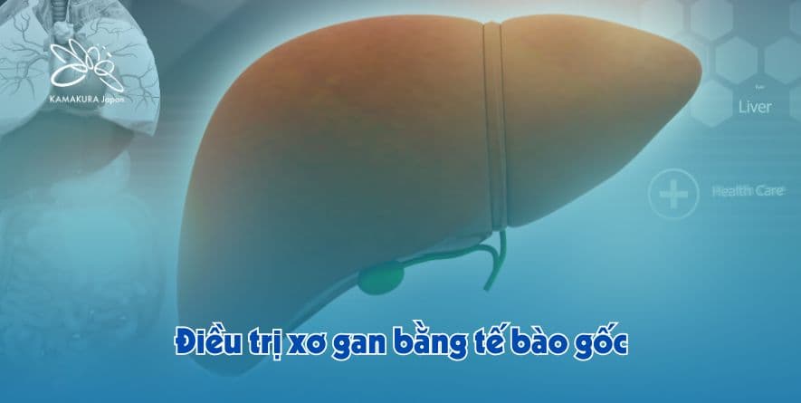 Tế bào gốc mở ra cơ hội phục hồi 70% cho bệnh nhân xơ gan giai đoạn sớm