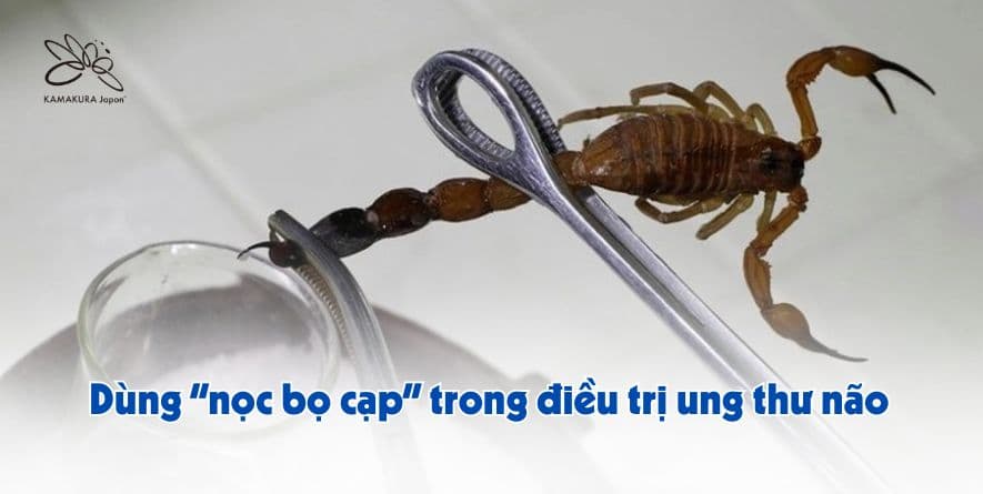 CLTX-CAR T: Dùng “nọc bọ cạp” dẫn đường - bước đột phá trong điều trị ung thư não (glioblastoma) của City of Hope