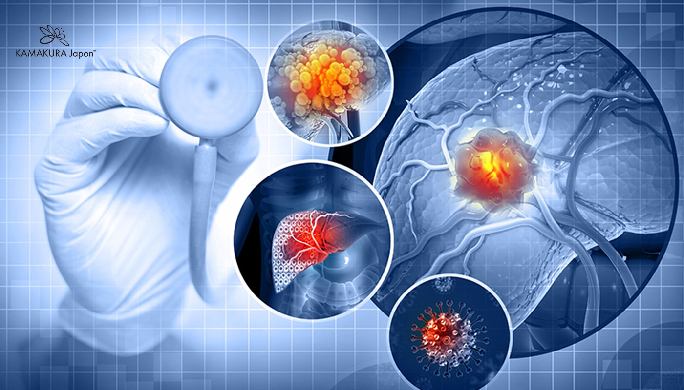 Ung Thư Gan: Vì Sao Tỷ Lệ Tử Vong Cao Và Những Hướng Điều Trị Mới