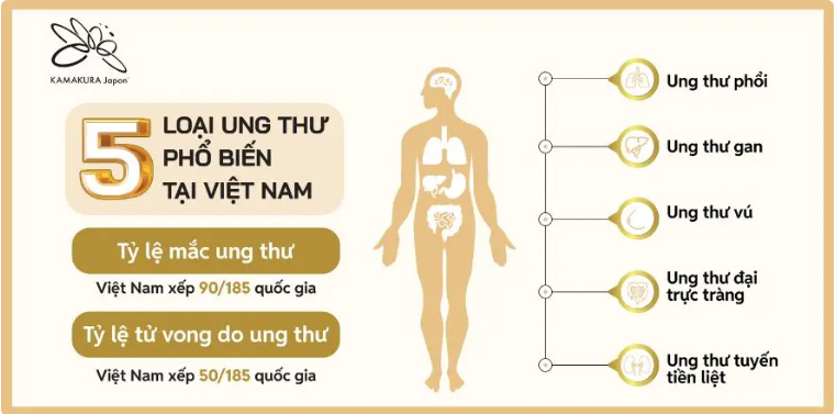 5 Bệnh Ung Thư Thường Gặp Ở Việt Nam Và Giải Pháp Điều Trị Hiệu Quả