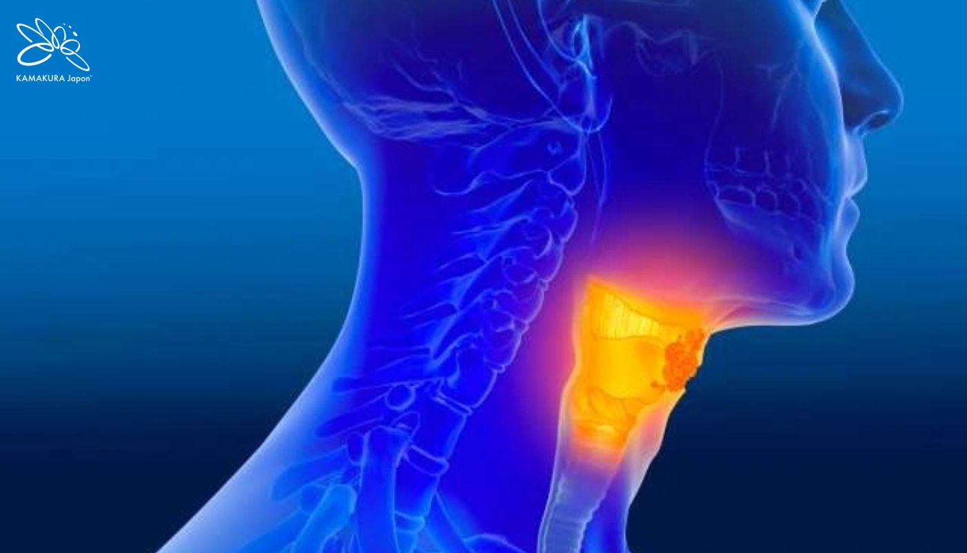 Ung thư đầu cổ: Tiên lượng thời gian sống và bước ngoặt điều trị thế hệ mới